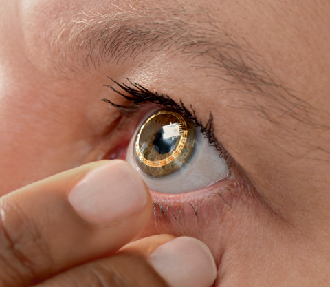 Sensimed’s Triggerfish smart contact lens, designed to detect tiny fluctuations in the eye’s volume, is just one such device that may be influenced by the FDA’s proposed new guidelines on health care technology. Photo: Sensimed
