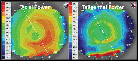 Fig. 2. These axial and tangential power maps show an eye wearing a +2.50 center distance soft multifocal lens design. 