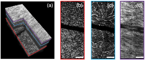 This 3D volume of the retina is corrected for defocus and higher order of phase error (a). The photoreceptor layer is red (b), the outer plexiform layer is blue (c) and the nerve fiber layer is violet (d). The white scale bar denotes 100μm. Photo: Laurin Ginner, PhD