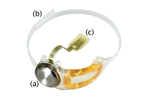 The implanted components of the Argus II Retinal Prosthesis System can be seen here.